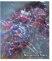 morgellons